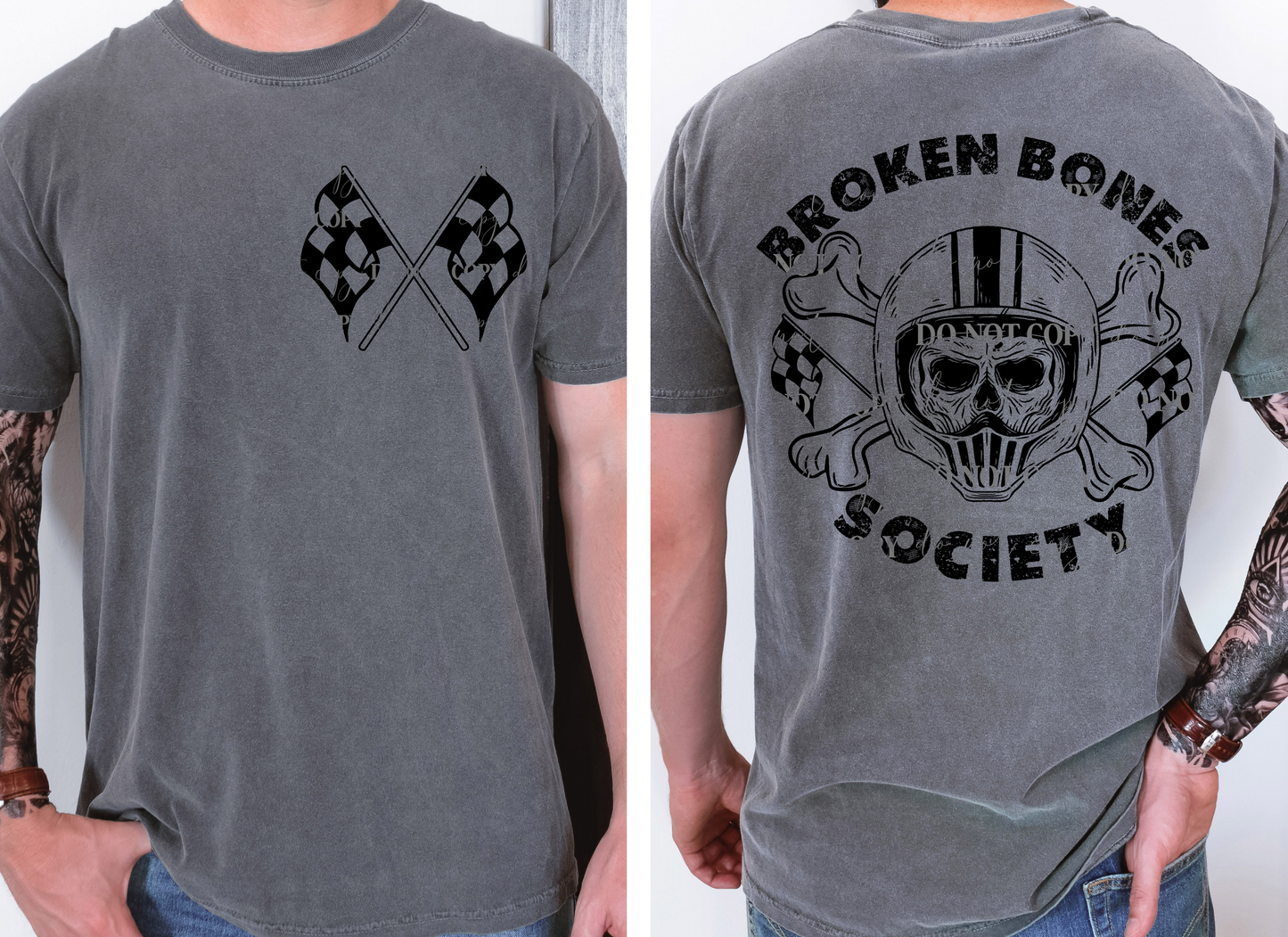 Broken bones society