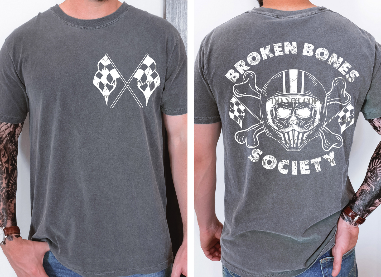 Broken bones society